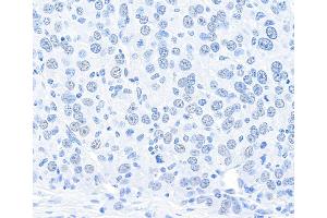 anti-Cleavage and Polyadenylation Specific Factor 1, 160kDa (CPSF1) (AA 1392-1442) antibody