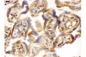 Immunohistochemistry (IHC) image for anti-Catechol-O-Methyltransferase (COMT) (AA 52-271) antibody (ABIN3043815)