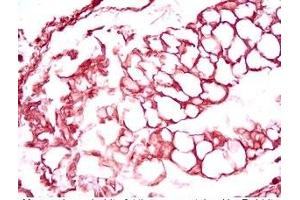 Immunohistochemistry (IHC) image for anti-serpin Peptidase Inhibitor, Clade A (Alpha-1 Antiproteinase, Antitrypsin), Member 12 (SERPINA12) (AA 63-104) antibody (ABIN2872791)
