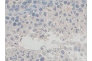 Detection of GFM1 in Mouse Testis Tissue using Polyclonal Antibody to G-Elongation Factor, Mitochondrial 1 (GFM1) (GFM1 Antikörper  (AA 511-751))