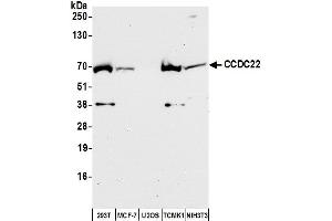 anti-Coiled-Coil Domain Containing 22 (CCDC22) (AA 577-627) antibody
