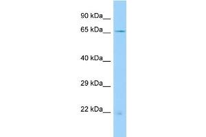 Host: Rabbit Target Name: ACSM4 Sample Type: MDA-MB-435S Whole Cell lysates Antibody Dilution: 1. (ACSM4 Antikörper  (N-Term))