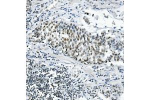 IHC analysis of PRDM5 using anti-PRDM5 antibody (ABIN7600853). (PRDM5 Antikörper  (AA 24-630))