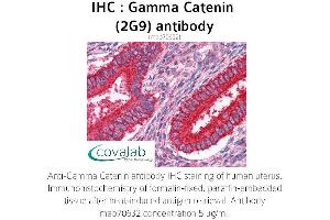 Image no. 2 for anti-Junction Plakoglobin (JUP) (AA 1-746), (full length) antibody (ABIN1723489) (JUP Antikörper  (full length))