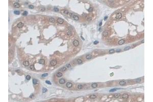 Immunohistochemistry (IHC) image for anti-Myosin Heavy Chain 7, Cardiac Muscle, beta (MYH7) (AA 26-309) antibody (ABIN7440755)