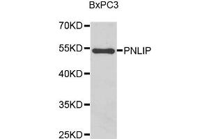 Western blot analysis of BxPC3 cell lysate using PNLIP antibody.