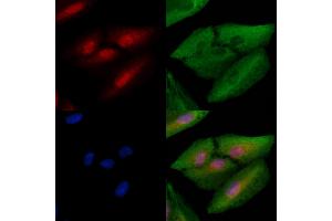 ABIN6261798 and ABIN6278670 staining  cells by IF/ICC. (FOXN1 Antikörper  (N-Term))