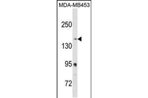 Western blot analysis in MDA-MB453 cell line lysates (35ug/lane). (RRBP1 Antikörper  (C-Term))