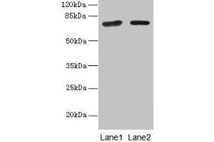 Western blot All lanes: KLHL22 antibody at 8 μg/mL Lane 1: Jurkat whole cell lysate Lane 2: NIH/3T3 whole cell lysate Secondary Goat polyclonal to rabbit IgG at 1/10000 dilution Predicted band size: 72, 56 kDa Observed band size: 72 kDa (KLHL22 Antikörper  (AA 2-300))
