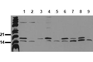Western Blotting (WB) image for anti-Microtubule-Associated Protein 1 Light Chain 3 beta (MAP1LC3B) (N-Term) antibody (ABIN492615) (LC3B Antikörper  (N-Term))