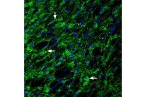 Expression of Glucagon-like peptide 1 receptor in rat hypothalamus - Immunohistochemical staining of rat hypothalamus with Anti-GLP1R (extracellular) Antibody (ABIN7043219, ABIN7044406 and ABIN7044407), (1:200). (GLP1R Antikörper  (Extracellular))