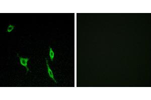 Peptide - +Immunofluorescence analysis of LOVO cells, using DCC antibody. (DCC Antikörper)