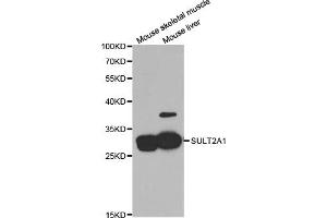 Western blot analysis of extracts of various cell lines, using SULT2A1 antibody (ABIN5973199) at 1/1000 dilution. (SULT2A1 Antikörper)