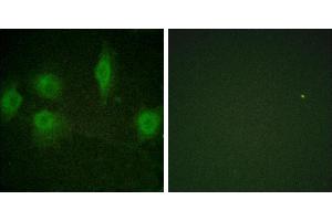 P-peptide - +Immunofluorescence analysis of HuvEc cells, using IL-9R (Phospho-Ser519) antibody. (IL9 Receptor Antikörper  (pSer519))
