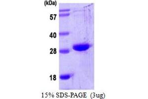 SDS-PAGE (SDS) image for Oncostatin M (OSM) (AA 26-234) protein (His tag) (ABIN667495)