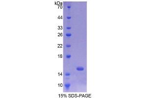 SDS-PAGE analysis of Rat PUMA Protein. (PUMA Protein)