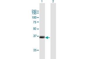 Western Blotting (WB) image for anti-Arginase, Type II (ARG2) (AA 1-354) antibody (ABIN513470)