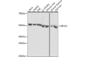 Western blot analysis of extracts of various cell lines, using EIF2S3 antibody (ABIN6130363, ABIN6140051, ABIN6140052 and ABIN6222259) at 1:1000 dilution. (EIF2S3 Antikörper  (AA 173-472))