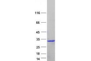 Western Blotting (WB) image for Interferon, alpha 8 (IFNA8) protein (Myc-DYKDDDDK Tag) (ABIN2723326)