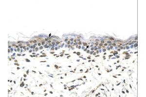 Immunohistochemistry (IHC) image for anti-Formiminotransferase Cyclodeaminase (FTCD) (N-Term) antibody (ABIN2776887) (FTCD Antikörper  (N-Term))