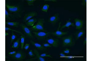 Immunofluorescence of monoclonal antibody to PDCL3 on HeLa cell. (PDCL3 Antikörper  (AA 1-239))