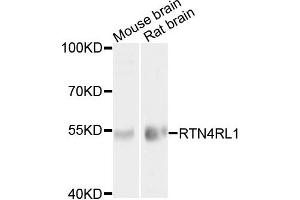 Western blot analysis of extracts of mouse brain and rat brain cells, using RTN4RL1 antibody. (RTN4RL1 Antikörper)