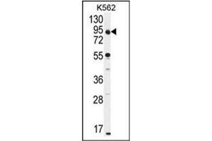 Western blot analysis of CCDC128 Antibody (Center) in K562 cell line lysates (35ug/lane). (KLRAQ1 Antikörper  (Middle Region))
