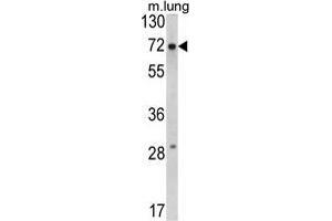 Western blot analysis of FMR1 Antibody (N-term) in mouse lung tissue lysates (35 µg/lane). (FMR1 Antikörper  (N-Term))