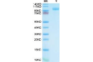 PSMA Protein (AA 44-750) (His tag)