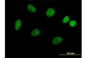 Immunofluorescence of purified MaxPab antibody to FLJ13798 on HeLa cell. (JMJD5 Antikörper  (AA 1-416))