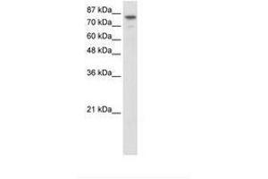 Image no. 1 for anti-Helicase-Like Transcription Factor (HLTF) (N-Term) antibody (ABIN307426)