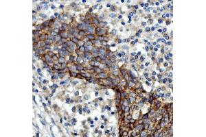 IHC analysis of EGFR using anti-EGFR antibody (ABIN7601478). (EGFR Antikörper  (AA 36-497))