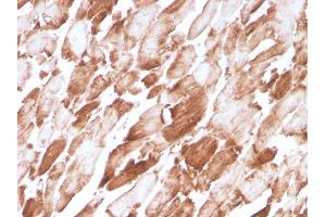 Formalin-fixed, paraffin-embedded human Cardiac Muscle stained with Sarcomeric Actinin Alpha 2 Mouse Monoclonal Antibody (ACTN2/3294). (ACTN2 Antikörper  (AA 557-692))