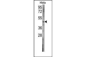 Image no. 1 for anti-BCL2-Like 13 (Apoptosis Facilitator) (BCL2L13) (C-Term) antibody (ABIN360243) (BCL2L13 Antikörper  (C-Term))