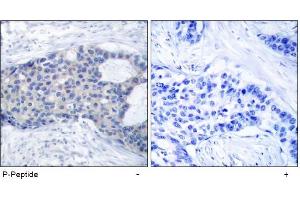 Image no. 1 for anti-zeta-Chain (TCR) Associated Protein Kinase 70kDa (ZAP70) (pTyr493) antibody (ABIN196886) (ZAP70 Antikörper  (pTyr493))