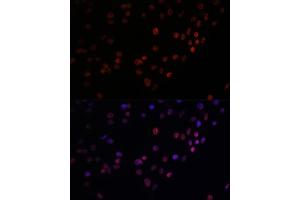 Immunofluorescence analysis of C6 cells using Matrin 3 antibody (ABIN7268415) at dilution of 1:100. (MATR3 Antikörper  (AA 747-847))