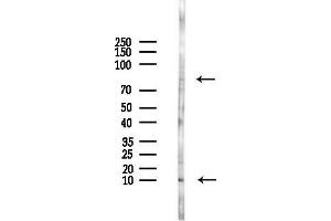 Western blot analysis of lysates from HepG2 cells(LPS,4h treatment), using NE Antibody at 1/1000 dilution.
