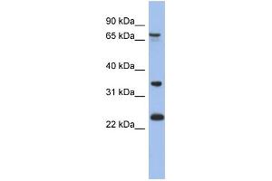 WB Suggested Anti-TBC1D25 Antibody Titration: 0. (TBC1D25 Antikörper  (N-Term))