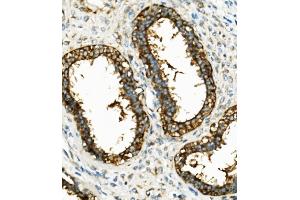 IHC analysis of Hexokinase 1/HK1 using anti-Hexokinase 1/HK1 antibody (ABIN7600259). (Hexokinase 1 Antikörper  (AA 17-323))