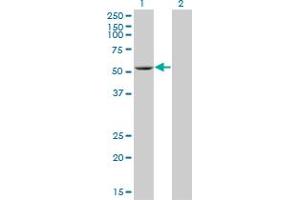 Western Blotting (WB) image for anti-ADP-Dependent Glucokinase (ADPGK) (AA 425-496) antibody (ABIN566495)