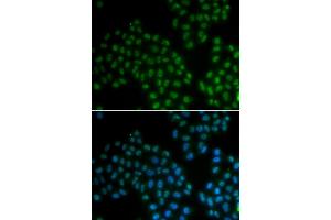 Immunofluorescence analysis of A549 cells using SOX2 antibody (ABIN5970209). (SOX2 Antikörper)