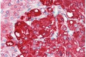 Human Adrenal: Formalin-Fixed, Paraffin-Embedded (FFPE)