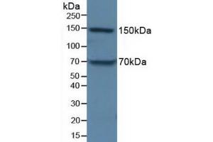 Figure. (APOB Antikörper  (AA 3365-3548))