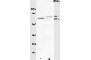 L1 mouse embryo lysate L2 human colon carcinoma lysates probed with Rabbit Anti-Frizzled 10/CD350 Polyclonal Antibody, Unconjugated  at 1:3000 for 90 min at 37˚C. (FZD10 Antikörper  (AA 101-200))