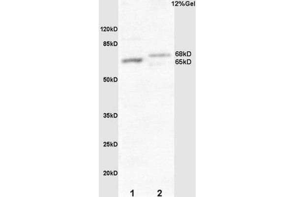 FZD10 Antikörper  (AA 101-200)
