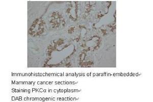 Staining with PRKCA antibody (PKC alpha Antikörper  (C-Term))