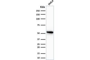 Western Blot Analysis of human HeLa cell lysate using Cytokeratin 7 Mouse Monoclonal Antibody (OV-TL12/30). (Cytokeratin 7 Antikörper)