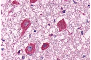 Anti-GPR40 antibody  ABIN1048820 IHC staining of human brain, neurons. (FFAR1 Antikörper  (C-Term))