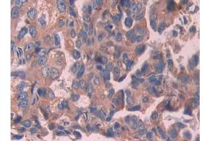 Used in DAB staining on fromalin fixed paraffin- embedded stomach cancer tissue (IL-24 Antikörper  (AA 51-206))