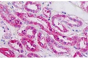 Human Kidney: Formalin-Fixed, Paraffin-Embedded (FFPE) (PLAGL1 Antikörper  (AA 311-360))